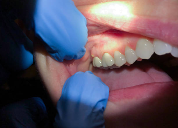 Best Emergency Dental Care for Trauma or Injury in Du Quoin, IL