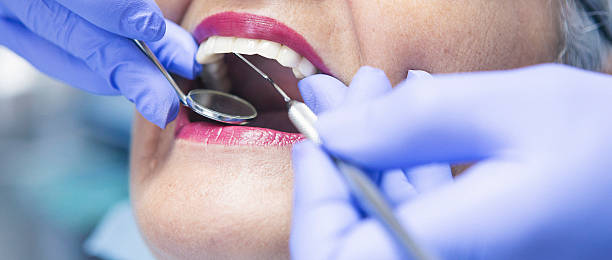 Best Emergency Treatment for Toothache in Du Quoin, IL